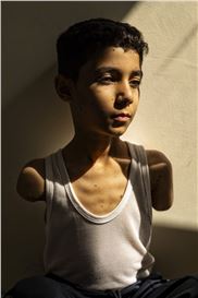 Photo of the Year: Injured Gazan Boy Captured by Samar Abu Elouf.
